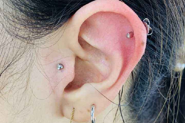 打耳骨后面長(zhǎng)了個(gè)肉坨坨怎么處理 打耳骨有什么風(fēng)險(xiǎn) 打耳骨后面長(zhǎng)了個(gè)肉坨坨怎么處理 打耳骨有什么風(fēng)險(xiǎn)