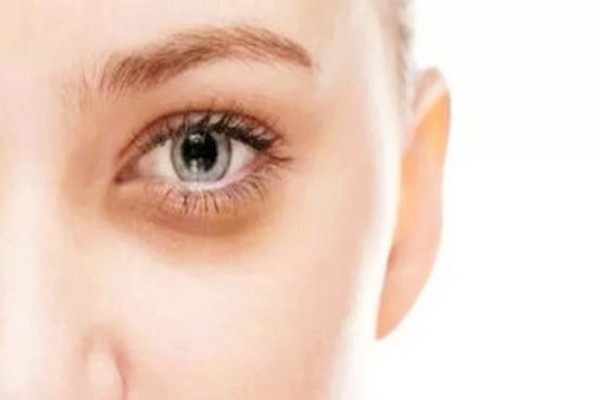 黑眼圈能用眼霜去掉嗎 黑眼圈能用遮瑕膏遮住嗎 黑眼圈能用眼霜去掉嗎 黑眼圈能用遮瑕膏遮住嗎