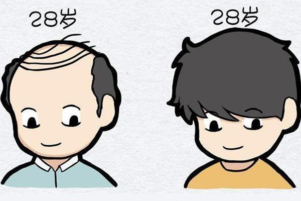 種植發(fā)際線(xiàn)能維持多久 種植發(fā)際線(xiàn)是永久的嗎