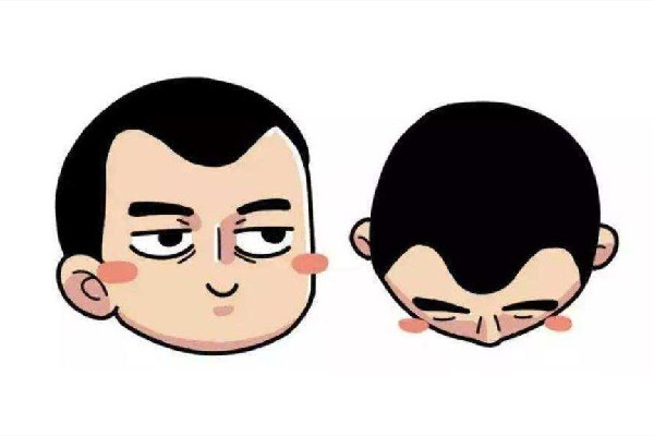 發(fā)際線會遺傳嗎 發(fā)際線會不會越來越高 發(fā)際線會遺傳嗎 發(fā)際線會不會越來越高