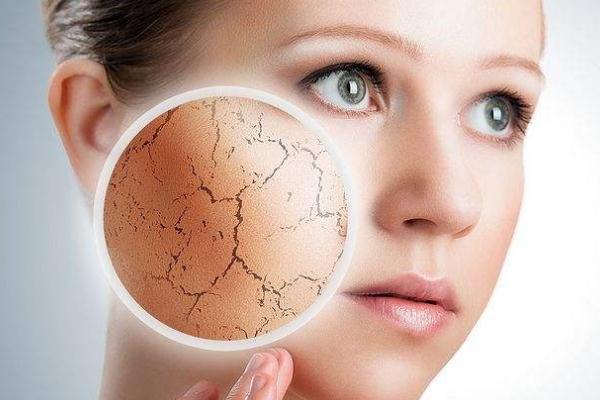 皮膚干燥怎樣治療 皮膚干燥缺什么維生素 皮膚干燥怎樣治療 皮膚干燥缺什么維生素