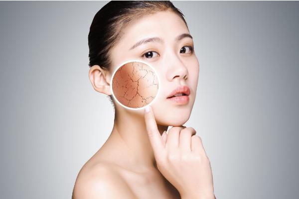 皮膚干燥的癥狀有哪些 皮膚干燥是什么器官有問題 皮膚干燥的癥狀有哪些 皮膚干燥是什么器官有問題