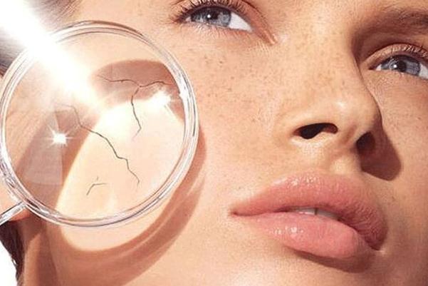 皮膚干燥的癥狀有哪些 皮膚干燥是什么器官有問題 皮膚干燥的癥狀有哪些 皮膚干燥是什么器官有問題