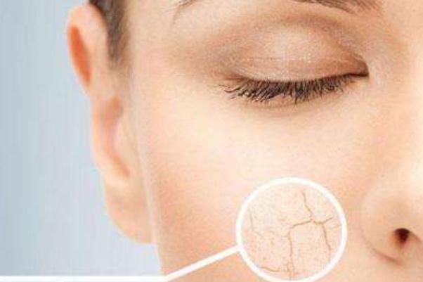 皮膚干燥的癥狀有哪些 皮膚干燥是什么器官有問題 皮膚干燥的癥狀有哪些 皮膚干燥是什么器官有問題