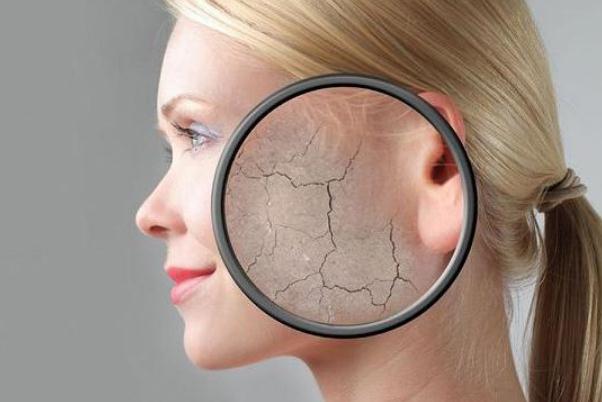 皮膚干燥怎樣治療 皮膚干燥缺什么維生素 皮膚干燥怎樣治療 皮膚干燥缺什么維生素