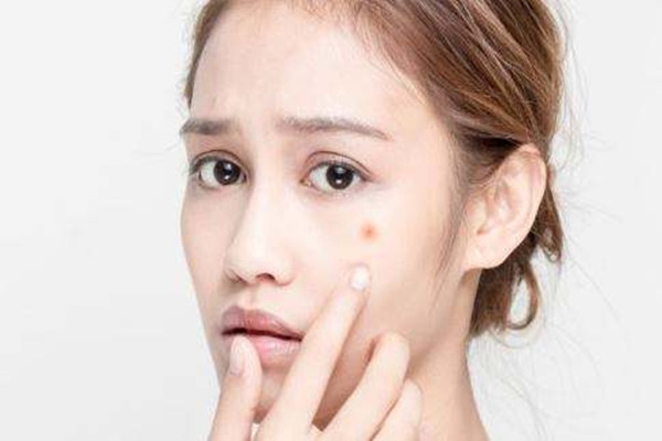 痘痘是怎么形成的 13歲女孩擠痘痘誘發(fā)敗血癥 痘痘是怎么形成的 13歲女孩擠痘痘誘發(fā)敗血癥