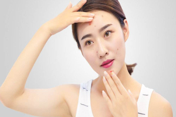 痘痘長到多少歲 長痘需要注意些什么 痘痘長到多少歲 長痘需要注意些什么