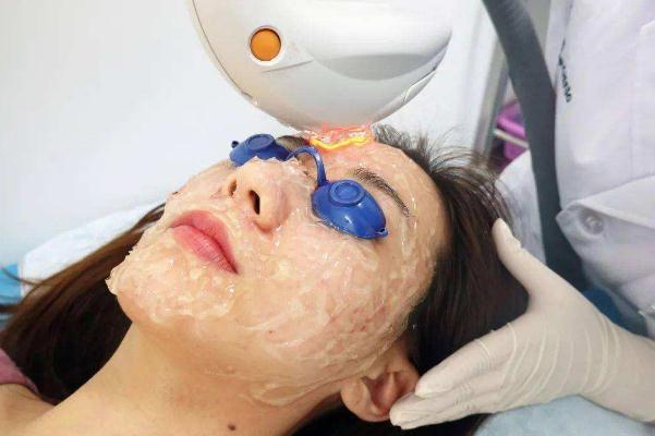 光子嫩膚一般多少錢一次 光子嫩膚的功效與作用 光子嫩膚一般多少錢一次 光子嫩膚的功效與作用
