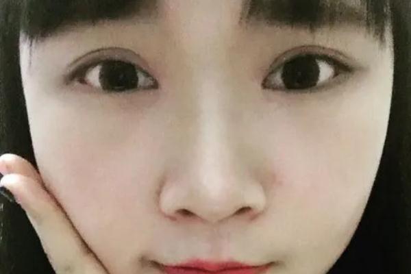 割雙眼皮會傷害眼睛嗎 割雙眼皮會割到眼部神經(jīng)嗎 割雙眼皮會傷害眼睛嗎 割雙眼皮會割到眼部神經(jīng)嗎