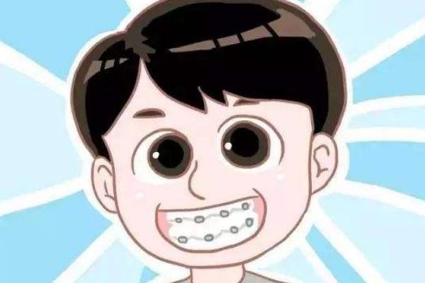 牙套會(huì)使牙齒松動(dòng)嗎 牙套會(huì)不會(huì)掉下來 牙套會(huì)使牙齒松動(dòng)嗎 牙套會(huì)不會(huì)掉下來