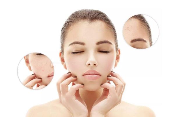 收縮毛孔可以用蘆薈膠嗎 收縮毛孔可以用水乳嗎 收縮毛孔可以用蘆薈膠嗎 收縮毛孔可以用水乳嗎