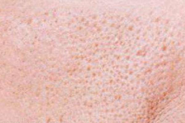 收縮毛孔可以用蘆薈膠嗎 收縮毛孔可以用水乳嗎 收縮毛孔可以用蘆薈膠嗎 收縮毛孔可以用水乳嗎