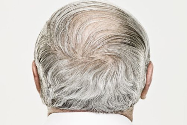 白頭發(fā)會不會越染越多 白頭發(fā)用淘米水洗有用嗎 白頭發(fā)會不會越染越多 白頭發(fā)用淘米水洗有用嗎