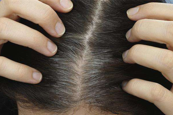 頭皮磨砂膏多久用一次 頭皮磨砂膏可以天天用嗎 頭皮磨砂膏多久用一次 頭皮磨砂膏可以天天用嗎