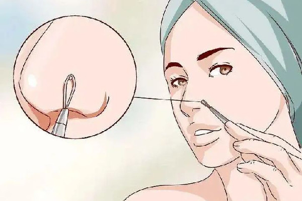 去黑頭洗面奶排行榜前十名 去黑頭洗面奶什么牌子好 去黑頭洗面奶排行榜前十名 去黑頭洗面奶什么牌子好