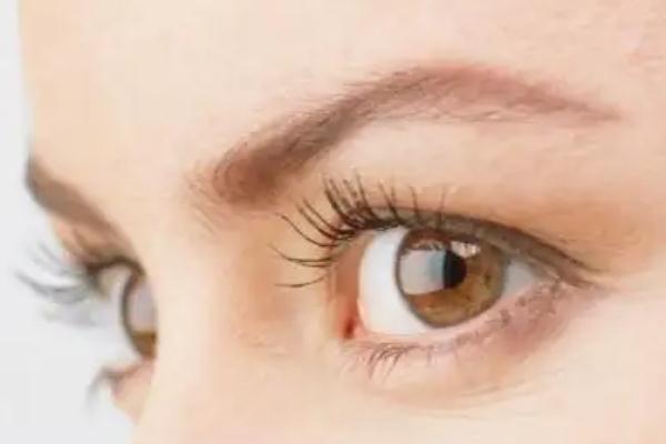 開眼角可以改善倒睫嗎 開眼角手術(shù)的安全性 開眼角可以改善倒睫嗎 開眼角手術(shù)的安全性