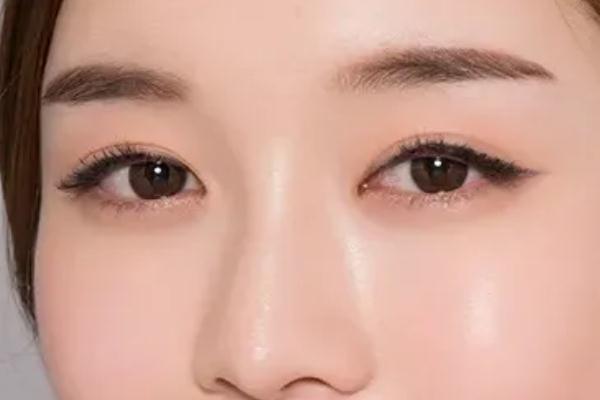 開眼角的恢復期是多久 開眼角要多久才能恢復正常 開眼角的恢復期是多久 開眼角要多久才能恢復正常