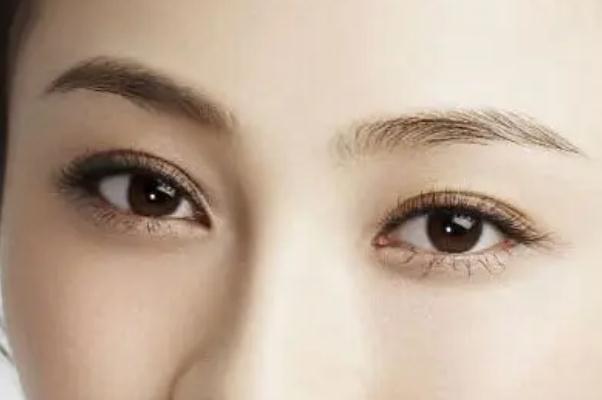 開眼角的回縮期是多久 開眼角是從哪個位置開 開眼角的回縮期是多久 開眼角是從哪個位置開