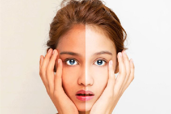 美白針真的可以全身美白嗎 美白針是永久性的嗎 美白針真的可以全身美白嗎 美白針是永久性的嗎