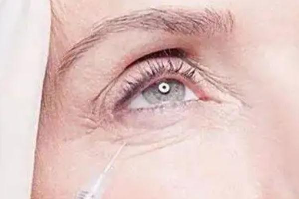 肉毒素除皺會引起眼皮腫嗎 肉毒素除皺對身體有害嗎 肉毒素除皺會引起眼皮腫嗎 肉毒素除皺對身體有害嗎