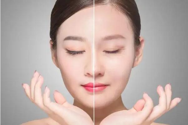 肉毒素除皺對(duì)視力有沒(méi)有影響 肉毒素除皺對(duì)皮膚好嗎 肉毒素除皺對(duì)視力有沒(méi)有影響 肉毒素除皺對(duì)皮膚好嗎