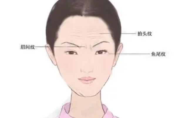 肉毒素除皺要忌口嗎 肉毒素除皺有效果嗎 肉毒素除皺要忌口嗎 肉毒素除皺有效果嗎