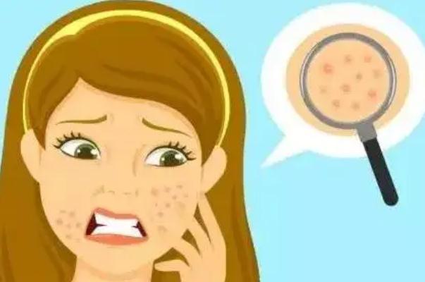 毛孔粗大要補水還是控油 毛孔粗大要不要用洗面奶 毛孔粗大要補水還是控油 毛孔粗大要不要用洗面奶