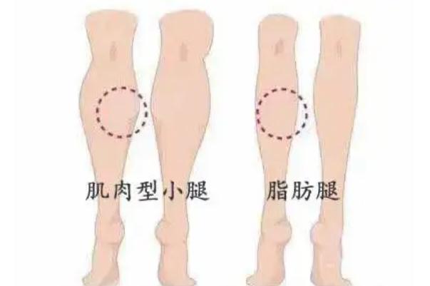 瘦腿針是瘦小腿還是大腿 瘦腿針打了能瘦大腿嗎 瘦腿針是瘦小腿還是大腿 瘦腿針打了能瘦大腿嗎