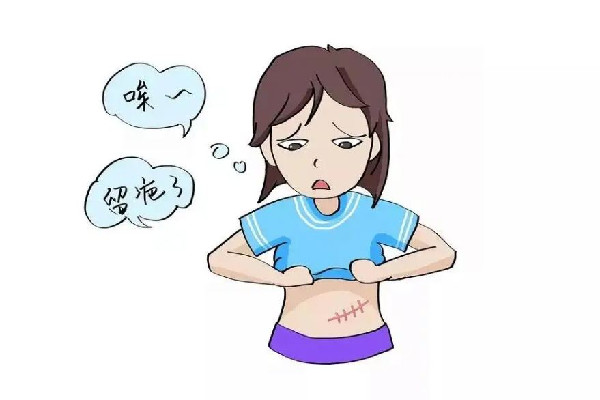 祛疤激光手術(shù)什么時(shí)候做最好 祛疤激光有幾種 祛疤激光手術(shù)什么時(shí)候做最好 祛疤激光有幾種