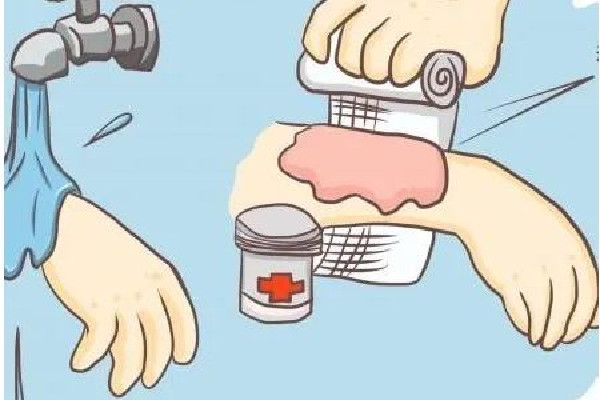 祛疤手術后要戒辛辣多長時間 祛疤手術后不能吃什么 祛疤手術后要戒辛辣多長時間 祛疤手術后不能吃什么