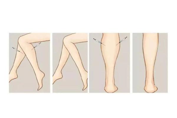 瘦腿針對(duì)脂肪腿有效果嗎 瘦腿針對(duì)身體有傷害嗎 瘦腿針對(duì)脂肪腿有效果嗎 瘦腿針對(duì)身體有傷害嗎