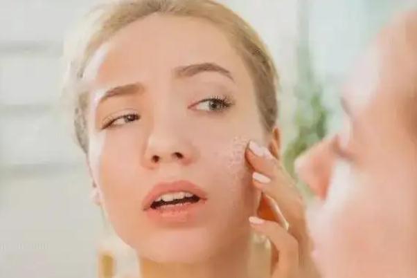 毛孔粗大會自己慢慢變小嗎 毛孔粗大會持續(xù)一輩子嗎 毛孔粗大會自己慢慢變小嗎 毛孔粗大會持續(xù)一輩子嗎