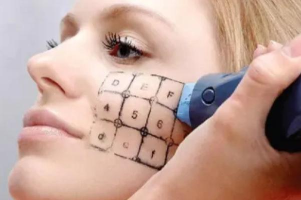 熱瑪吉有輻射嗎 熱瑪吉有恢復(fù)期嗎 熱瑪吉有輻射嗎 熱瑪吉有恢復(fù)期嗎