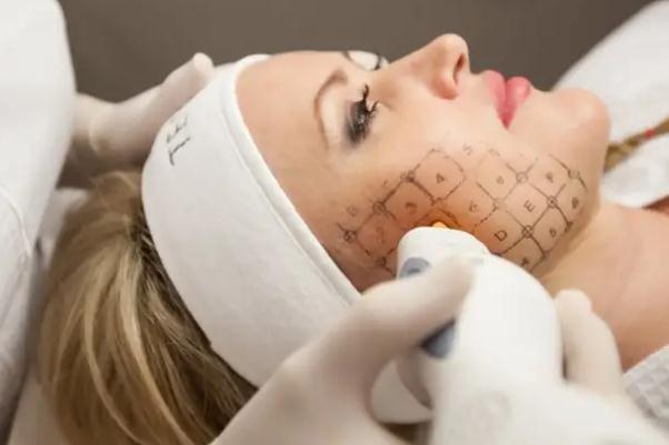 熱瑪吉有什么效果和副作用 熱瑪吉一次能保持多久 熱瑪吉有什么效果和副作用 熱瑪吉一次能保持多久