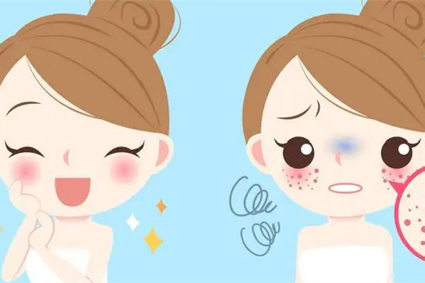 皮秒祛斑是不是永久的 皮秒祛斑要做幾次才能干凈 皮秒祛斑是不是永久的 皮秒祛斑要做幾次才能干凈