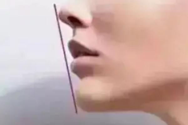 玻尿酸填充下巴是不是越尖越好 玻尿酸填充下巴是怎么形成的 玻尿酸填充下巴是不是越尖越好 玻尿酸填充下巴是怎么形成的