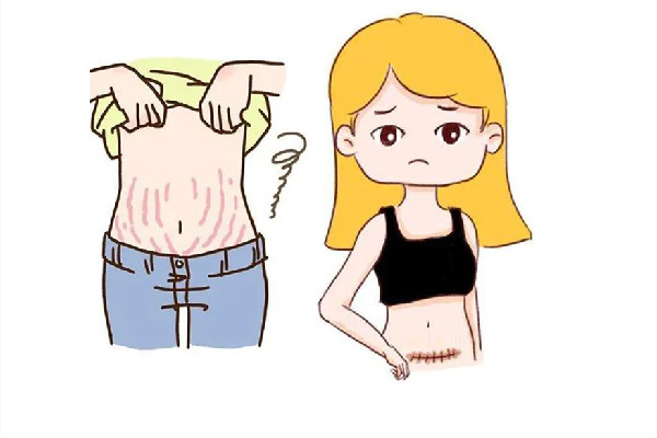 肥胖紋有時(shí)候明顯有時(shí)候不明顯 肥胖紋會一直擴(kuò)散嗎 肥胖紋有時(shí)候明顯有時(shí)候不明顯 肥胖紋會一直擴(kuò)散嗎