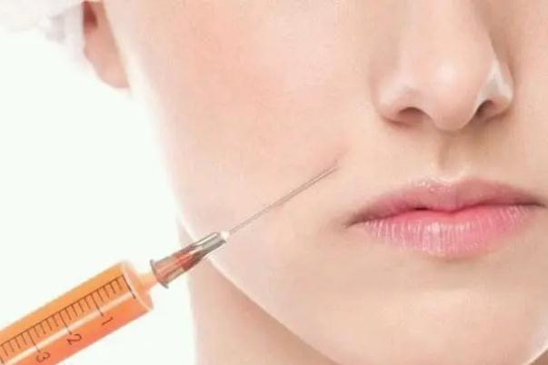 玻尿酸填充下巴多久定型 玻尿酸填充下巴多久可以化妝 玻尿酸填充下巴多久定型 玻尿酸填充下巴多久可以化妝