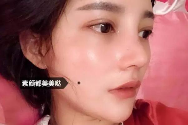 耳軟骨隆鼻有什么后遺癥 耳軟骨隆鼻有點(diǎn)歪可以調(diào)整嗎 耳軟骨隆鼻有什么后遺癥 耳軟骨隆鼻有點(diǎn)歪可以調(diào)整嗎