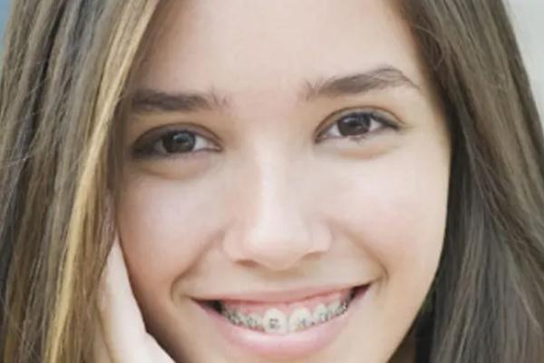 戴牙套痛不痛 戴牙套不能吃什么 戴牙套痛不痛 戴牙套不能吃什么