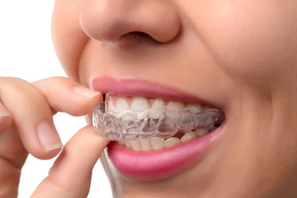 戴牙套痛不痛 戴牙套不能吃什么 戴牙套痛不痛 戴牙套不能吃什么