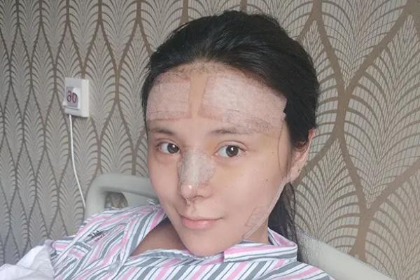 耳軟骨隆鼻是取一側(cè)還是兩側(cè) 耳軟骨隆鼻是用自己的耳軟骨嗎 耳軟骨隆鼻是取一側(cè)還是兩側(cè) 耳軟骨隆鼻是用自己的耳軟骨嗎