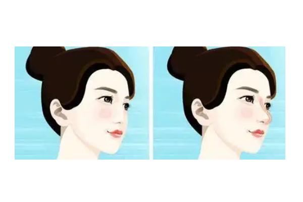 耳軟骨隆鼻是取耳朵哪里的骨頭 耳軟骨隆鼻是全麻還是局麻 耳軟骨隆鼻是取耳朵哪里的骨頭 耳軟骨隆鼻是全麻還是局麻