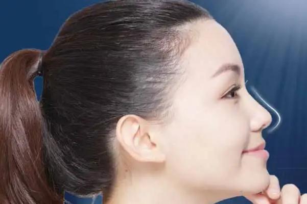 膨體隆鼻要忌口多長(zhǎng)時(shí)間 膨體隆鼻有什么危害 膨體隆鼻要忌口多長(zhǎng)時(shí)間 膨體隆鼻有什么危害