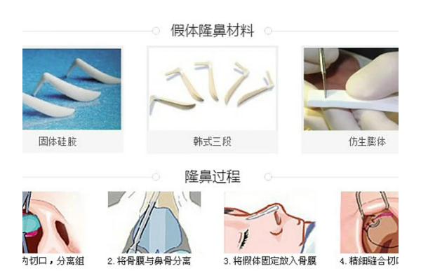 膨體隆鼻可以一輩子不取出來嗎 膨體隆鼻可以維持多少年 膨體隆鼻可以一輩子不取出來嗎 膨體隆鼻可以維持多少年