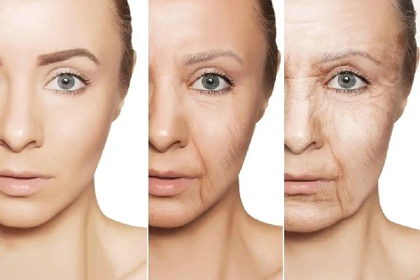 除皺針打完笑容僵硬多久能恢復(fù) 除皺針打完后有什么反應(yīng) 除皺針打完笑容僵硬多久能恢復(fù) 除皺針打完后有什么反應(yīng)