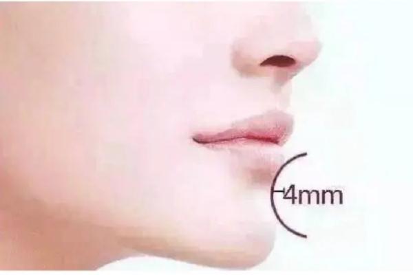 玻尿酸豐下巴多久恢復(fù)自然 玻尿酸豐下巴后遺癥 玻尿酸豐下巴多久恢復(fù)自然 玻尿酸豐下巴后遺癥