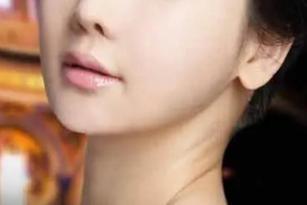 豐下巴會不會產(chǎn)生木偶紋 豐下巴會不會臉部下垂 豐下巴會不會產(chǎn)生木偶紋 豐下巴會不會臉部下垂