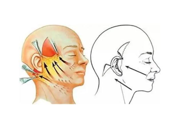 拉皮手術(shù)是拉的筋膜層還是皮膚層 拉皮手術(shù)是大手術(shù)嗎 拉皮手術(shù)是拉的筋膜層還是皮膚層 拉皮手術(shù)是大手術(shù)嗎