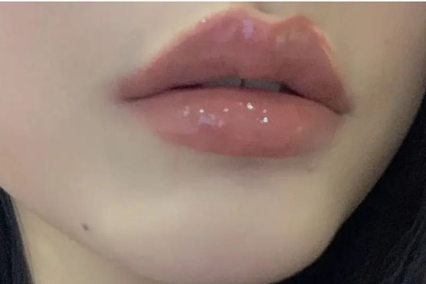 豐唇大概要多少錢(qián) 豐唇有哪些方法 豐唇大概要多少錢(qián) 豐唇有哪些方法